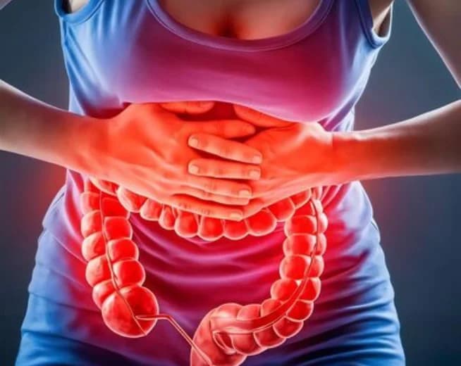 "Tengo colitis": lo que ese diagnóstico sí y no significa