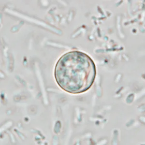 Ciclosporiasis al microscopio