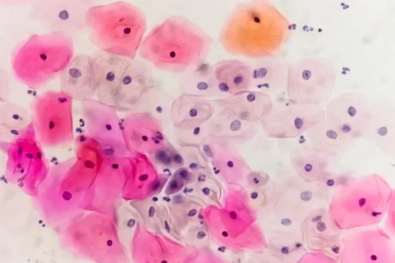 Virus VPH al microscopio.